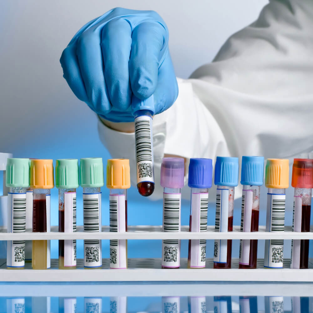 zabiegi laboratoryjne